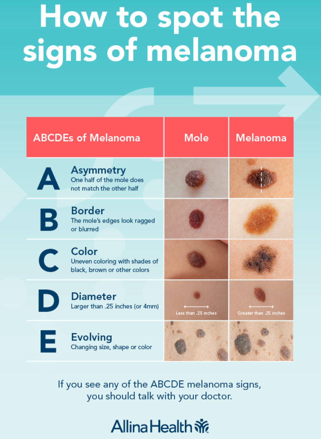 ABCDE - Signs of Melanoma